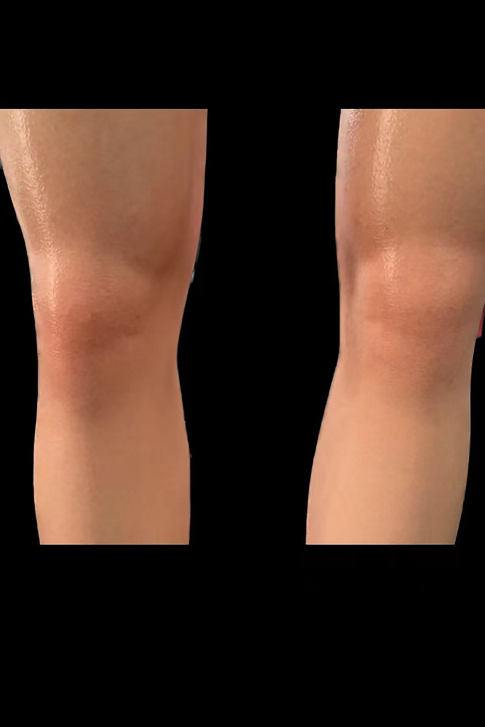 Corrinne 158cm 30# Small Breasts Young Girl Love Doll Realistic Full Silicone Sex Doll